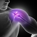 Shoulder Impingement Syndrome: Causes, Symptoms & Treatment Explained