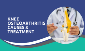 Knee Osteoarthritis Causes & Treatment
