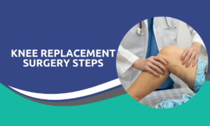 Knee Replacement Surgery Steps
