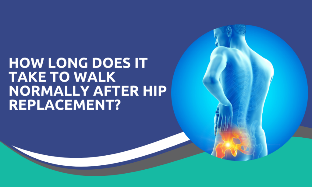 How Long Does It Take to Walk Normally After Hip Replacement?