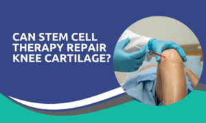 Stem Cell Therapy Repair Knee Cartilage