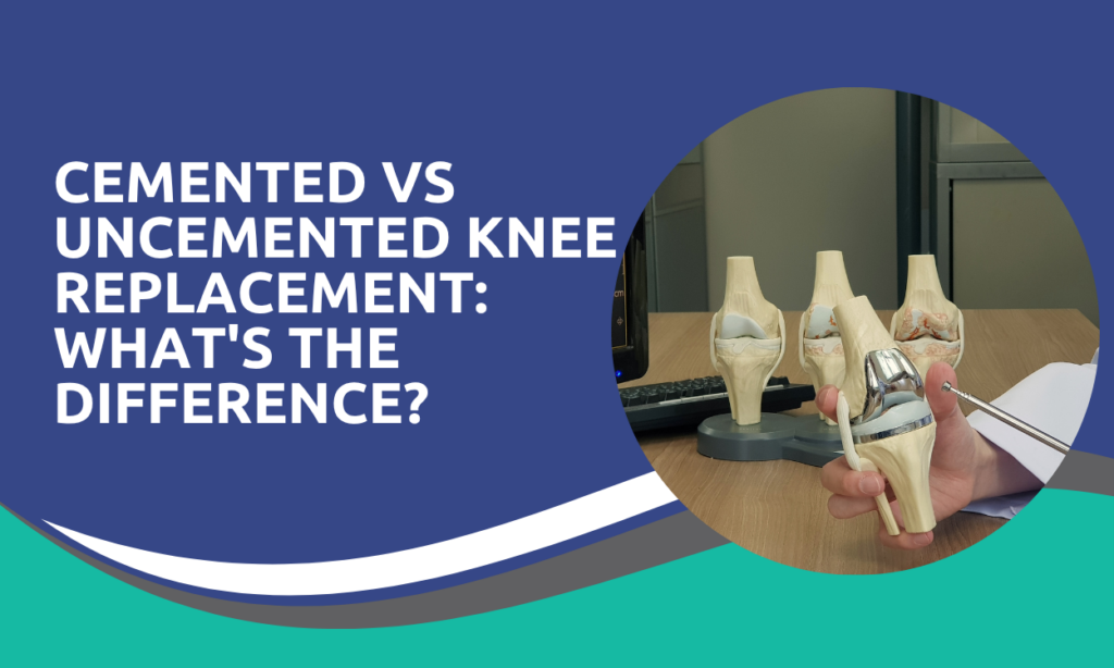 Cemented vs Uncemented Knee Replacement: What’s the Difference?