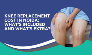Knee Replacement Cost in Noida