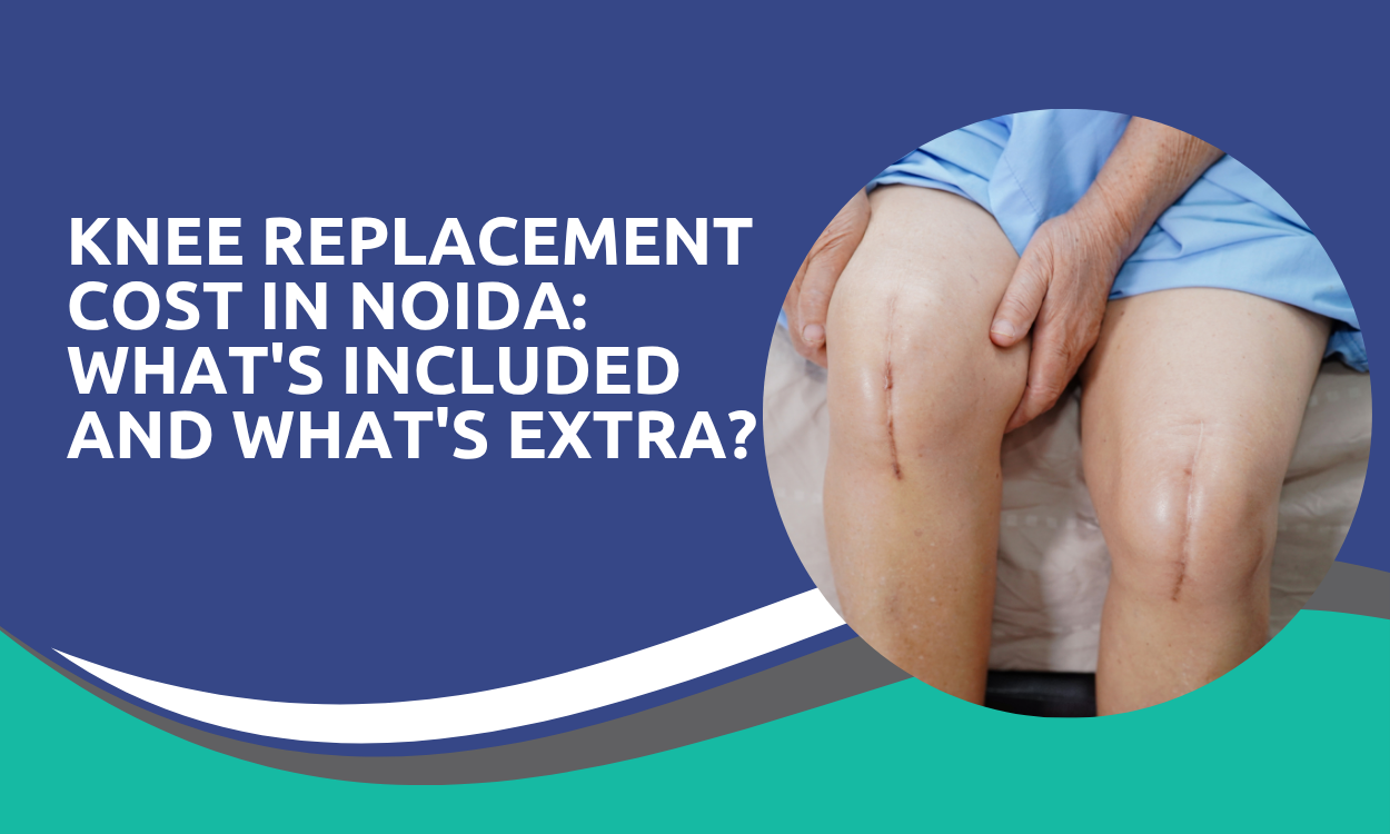 Knee Replacement Cost in Noida