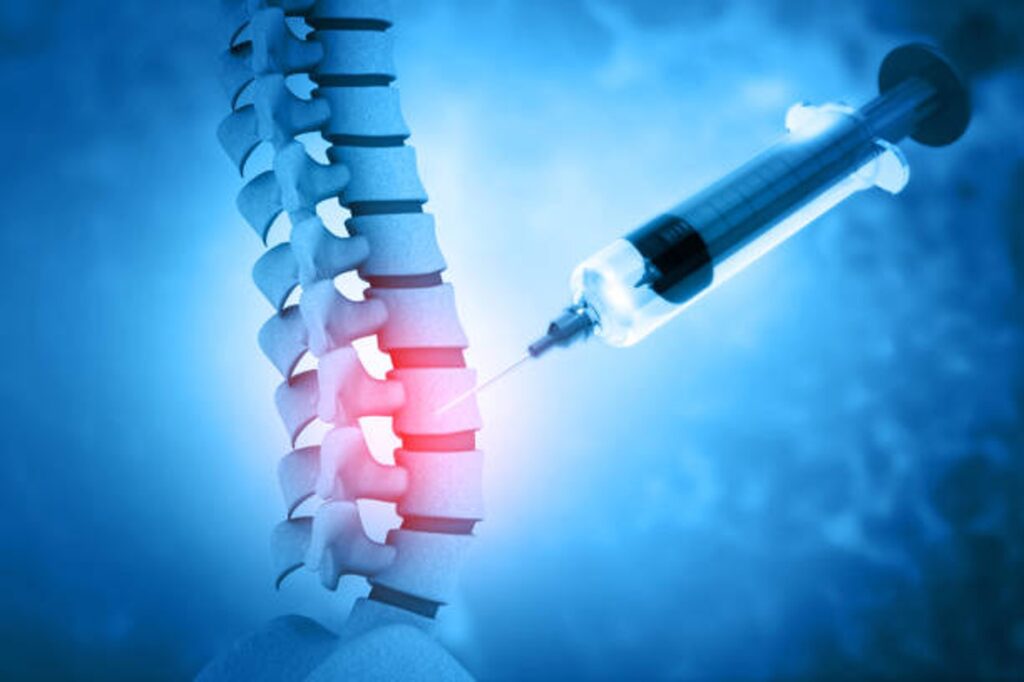 Medical illustration of a spinal column with a syringe near the lumbar region, highlighting the lower back in red to indicate injection therapy.