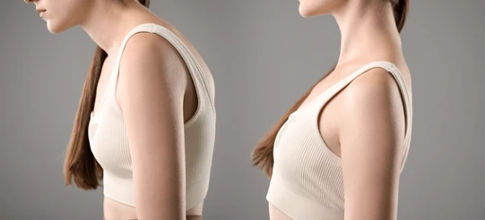 Side-by-side profile shots showing slouched posture on the left and upright posture on the right.