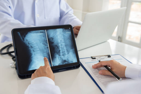 Doctor or clinician points to spine X-ray images on a tablet during a medical consultation, with a clipboard and stethoscope visible on the desk.