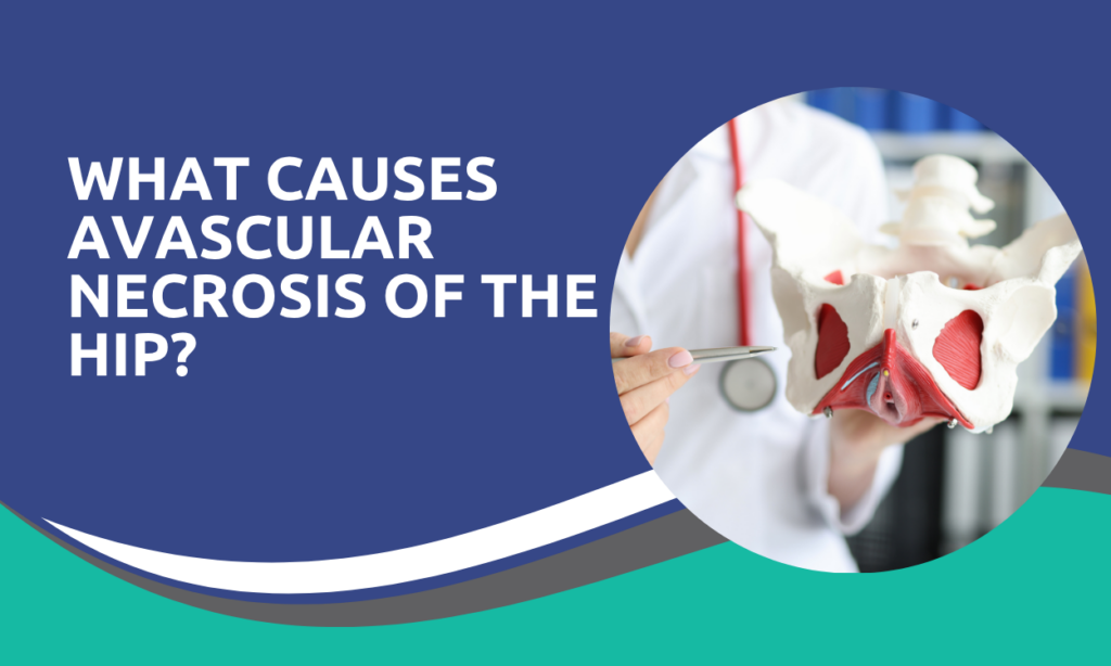 What Causes Avascular Necrosis of the Hip?