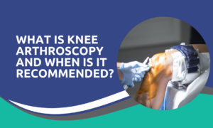 What Is Knee Arthroscopy and When Is It Recommended