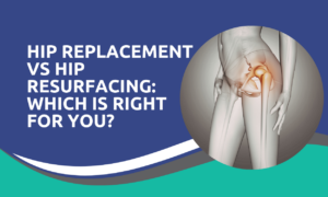 Hip Replacement vs Hip Resurfacing