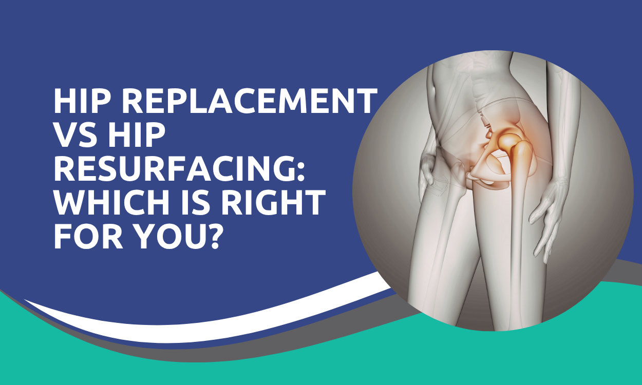 Hip Replacement vs Hip Resurfacing
